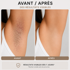 SKINIQO INGROWN FIX - le soin anti-poils incarnés.