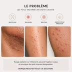 SKINIQO INGROWN FIX - le soin anti-poils incarnés.