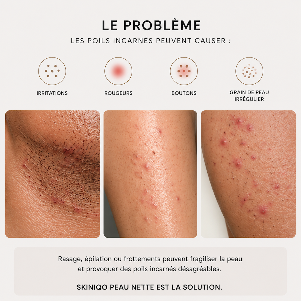 SKINIQO INGROWN FIX - le soin anti-poils incarnés.